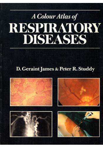 Stock image for A Colour Atlas of Respiratory Diseases for sale by HPB-Red