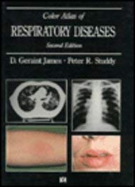 Beispielbild fr A Color Atlas of Respiratory Disease zum Verkauf von Ammareal