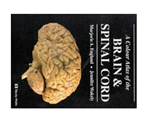 Stock image for A Colour Atlas of Brain and Spinal Cord for sale by AwesomeBooks
