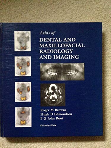 Stock image for Atlas of Dental and Maxilofacial Radiology and Imaging for sale by Webbooks, Wigtown