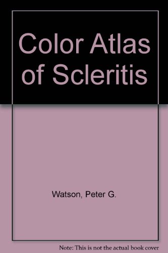 9780723417538: Colour Atlas of Scleritis