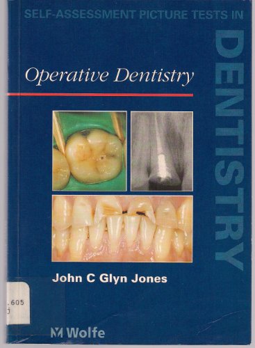 Imagen de archivo de Self Assessment Picture Tests in Dentistry: Operative Dentistry (Self-assessment Picture Tests in Dentistry S.) a la venta por WorldofBooks
