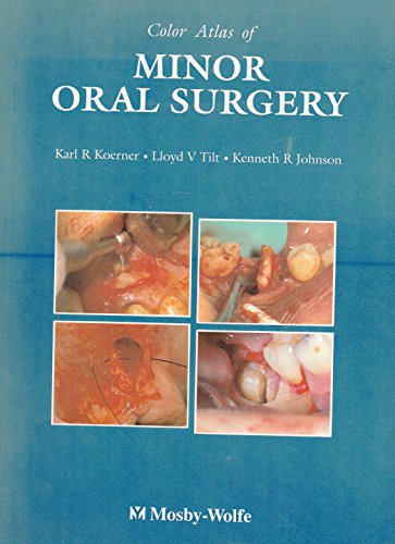 Imagen de archivo de Atlas of Minor Oral Surgery a la venta por Zoom Books Company