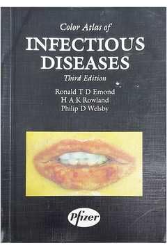 Stock image for Colour Atlas of Infectious Diseases for sale by Better World Books