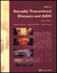 9780723421436: Atlas of Sexually Transmitted Diseases and AIDS