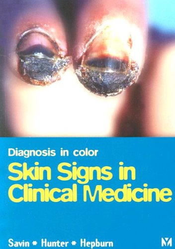 Stock image for Diagnosis In Color: Skin Signs in Clinical Medicine (Diagnosis in Colour) for sale by HPB-Red
