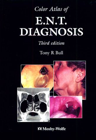 Color Atlas of Ent Diagnosis (9780723422716) by Bull, T. R.
