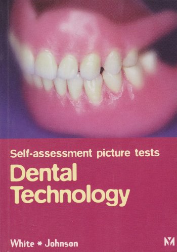 Stock image for Self-Assessment Picture Test: Dental Technology for sale by HPB-Red