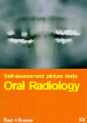 Stock image for Self Assessment Picture Tests in Dentistry: Oral Radiology for sale by Discover Books