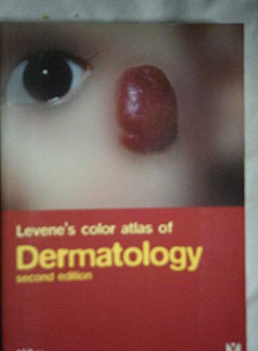 Stock image for Levene's Color Atlas of Dermatology (Diagnosis in Colour) for sale by WorldofBooks