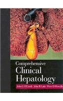9780723431060: Comprehensive Clinical Hepatology: Text with CD-ROM