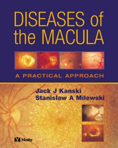 9780723432418: Diseases of the Macula: A Practical Approach