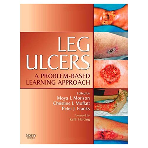 Imagen de archivo de Leg Ulcers : A Problem-Based Learning Approach a la venta por Better World Books Ltd