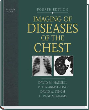 9780723433231: Imaging of Diseases of the Chest