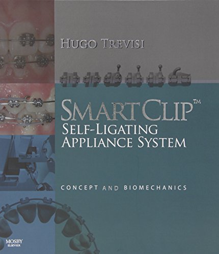 SmartClip Self-Ligating Appliance System: Concept and Biomechanics - Trevisi DDS, Hugo