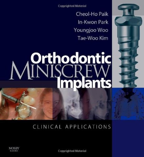 Beispielbild fr Orthodontic Miniscrew Implants: Clinical Applications zum Verkauf von PAPER CAVALIER UK