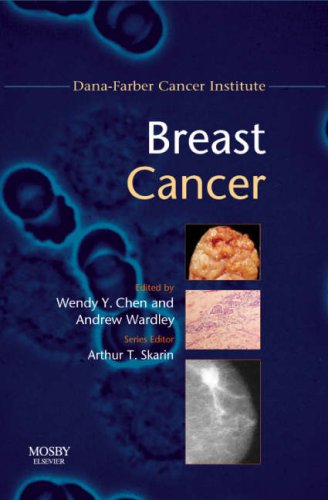 Breast Cancer: Dana-Farber Cancer Institute Handbook, 1e (Dana-Farber Cancer Institute Handbooks)