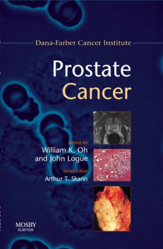 Stock image for Prostate Cancer: Dana-Farber Cancer Institute Handbook (Dana-Farber Cancer Institute Handbooks) for sale by Phatpocket Limited