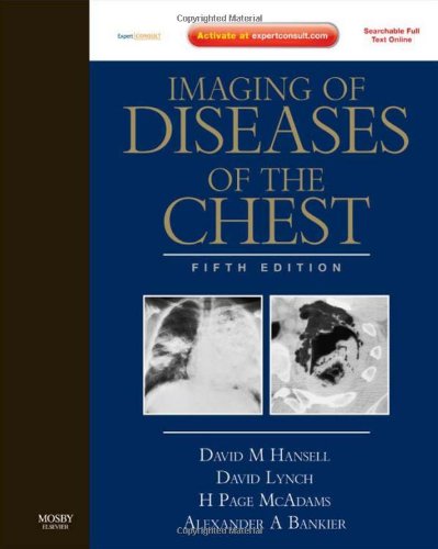 Imaging of Diseases of the Chest: Expert Consult - Online and Print (9780723434962) by Hansell, David M.; Lynch MD, David A.; McAdams MD, H. Page; Bankier MD, Alexander A.