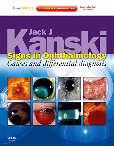 Imagen de archivo de Signs in Ophthalmology: Causes and Differential Diagnosis: Expert Consult - Online and Print a la venta por Mispah books
