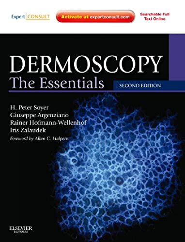 9780723435921: Dermoscopy: The Essentials: Expert Consult - Online and Print, 2e
