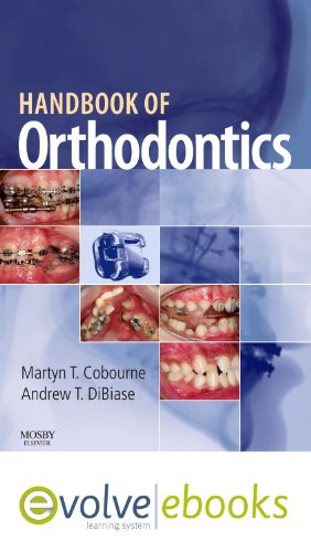9780723435952: Handbook of Orthodontics