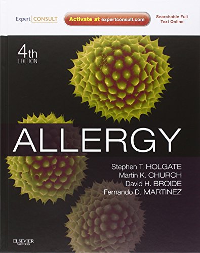 9780723436584: Allergy: Expert Consult Online and Print, 4e