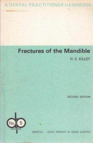 Fractures of the mandible, (A Dental practitioner handbook) (9780723602958) by Killey, H. C