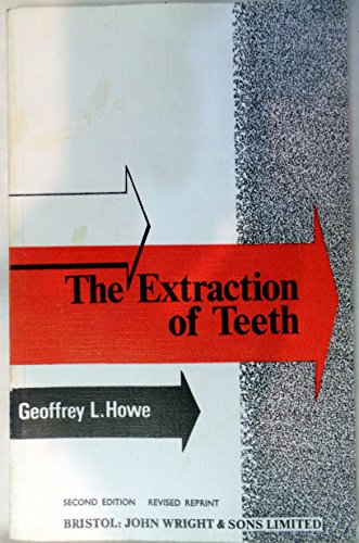 9780723603832: Extraction of Teeth