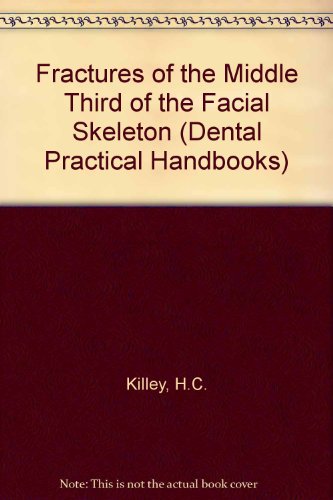 9780723603948: Fractures of the Middle Third of the Facial Skeleton (Dental Practical Handbooks)