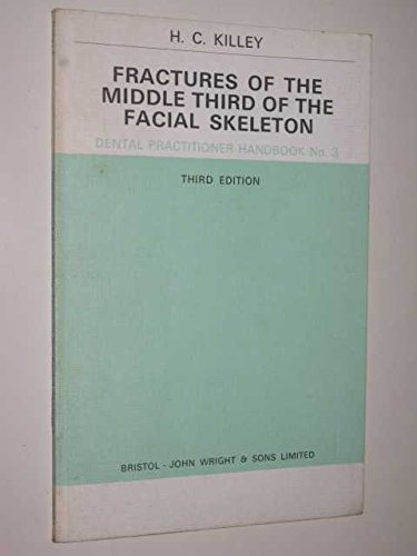 Fractures of the middle third of the facial skeleton (A Dental practitioner handbook ; no. 3) (9780723604594) by Killey, H. C