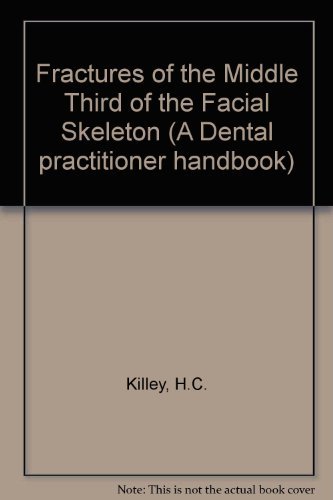 Stock image for Fractures of the Middle Third of the Facial Skeleton (A Dental practitioner handbook) for sale by RIVERLEE BOOKS