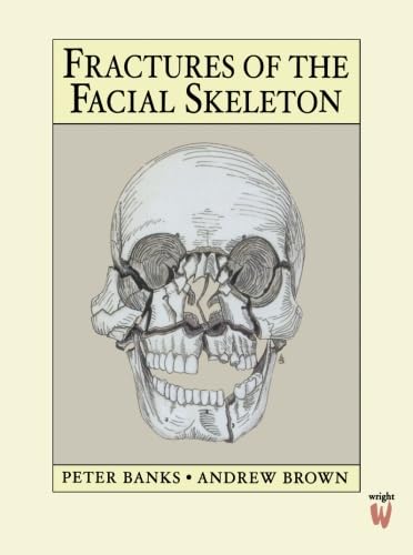 Imagen de archivo de Fractures of the Facial Skeleton a la venta por Better World Books