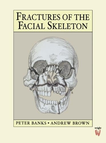 9780723610342: Fractures of the Facial Skeleton, 1e