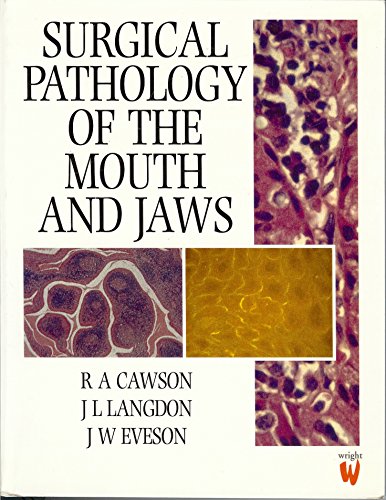 9780723610830: Surgical Pathology of the Mouth and Jaw