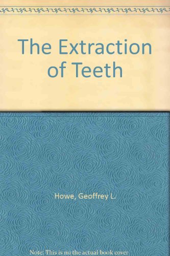 9780723622314: Extraction of Teeth