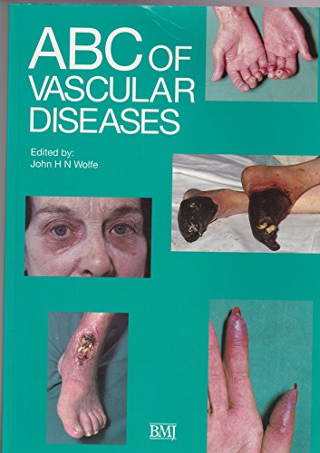 Beispielbild fr ABC of Vascular Diseases (ABC Series) zum Verkauf von WorldofBooks