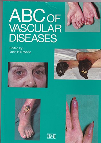 9780727902597: ABC of Vascular Diseases