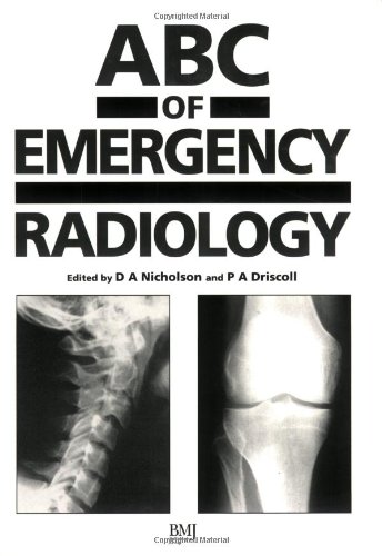 Beispielbild fr ABC of Emergency Radiology (ABC Series) zum Verkauf von WorldofBooks