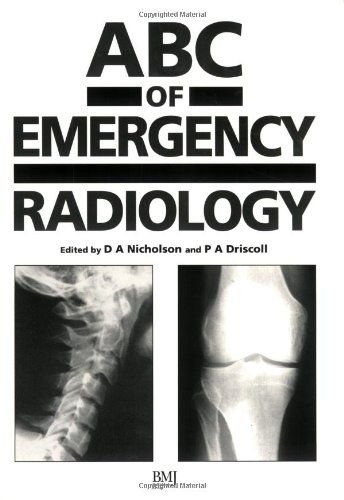 Imagen de archivo de ABC of Emergency Radiology (ABC Series) a la venta por WorldofBooks