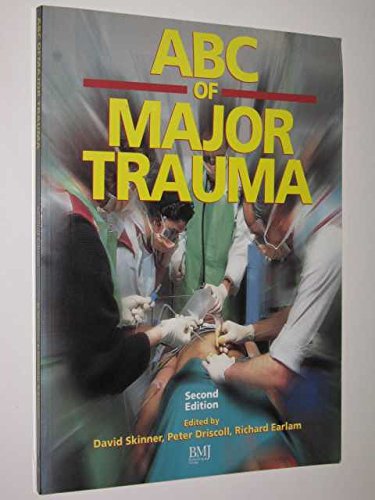 Imagen de archivo de ABC of Major Trauma a la venta por MusicMagpie