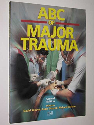 Stock image for ABC of Major Trauma for sale by MusicMagpie