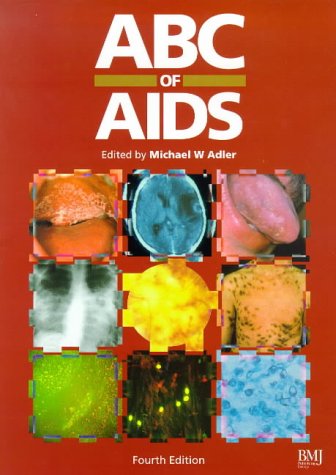 Beispielbild fr ABC of AIDS (ABC Series) zum Verkauf von AwesomeBooks