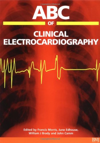 9780727915368: ABC of Clinical Electrocardiography (ABC Series)