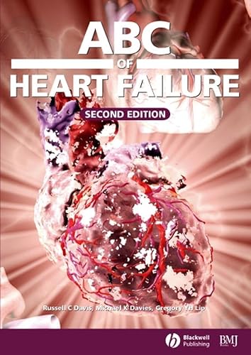 9780727916440: ABC of Heart Failure