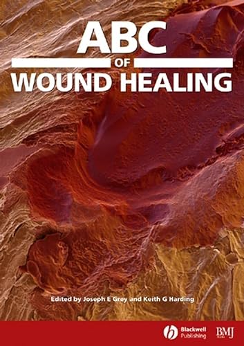 Imagen de archivo de ABC of Wound Healing a la venta por Better World Books