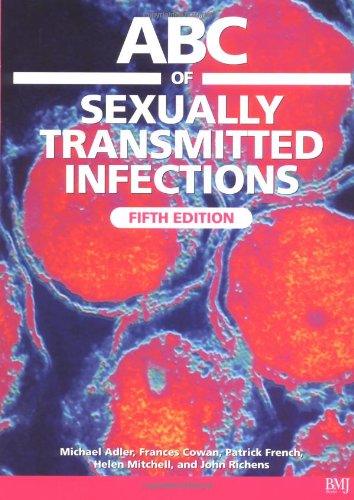 9780727917614: ABC of Sexually Transmitted Infections (ABC S.)