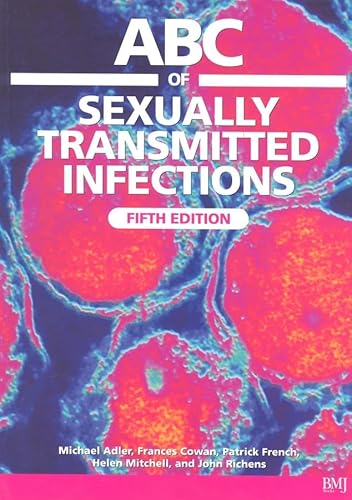 Stock image for ABC of Sexually Transmitted Infections (ABC Series) for sale by BookHolders