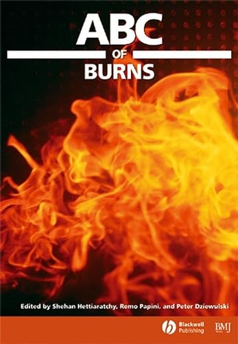 Beispielbild fr ABC of Burns (ABC Series) zum Verkauf von WorldofBooks