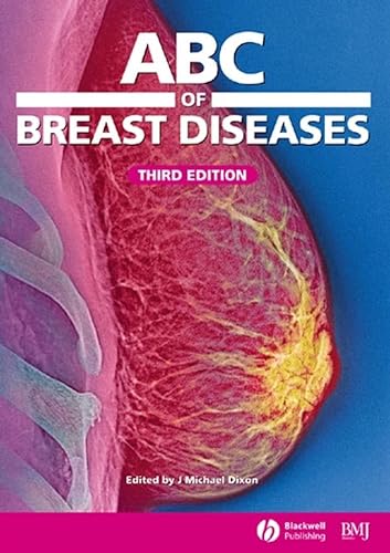 Stock image for ABC of Breast Diseases (ABC Series) for sale by WorldofBooks